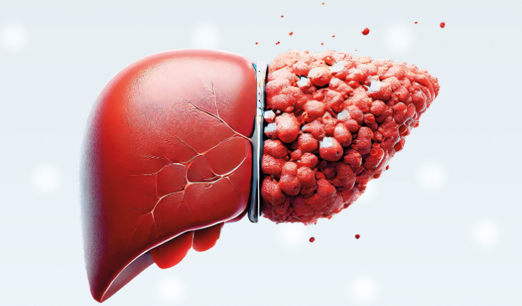 Farmacêuticos do SUS podem aumentar adesão ao tratamento de pessoas com hepatites virais