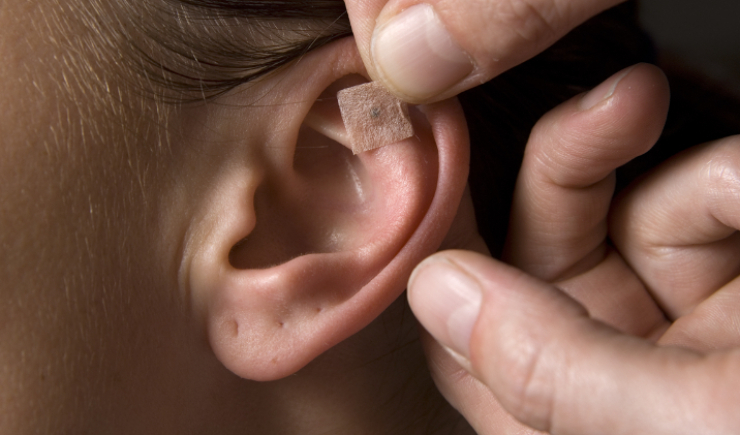 Ministério da Saúde abre inscrições para curso semipresencial de auriculoterapia