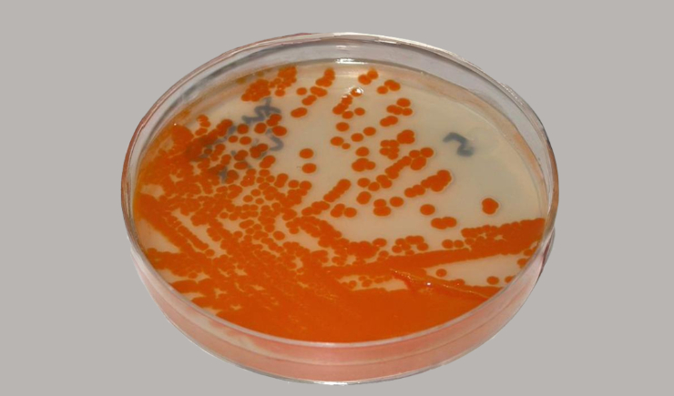 Bactéria comum em gestantes está circulando mais e com maior resistência aos antibióticos
