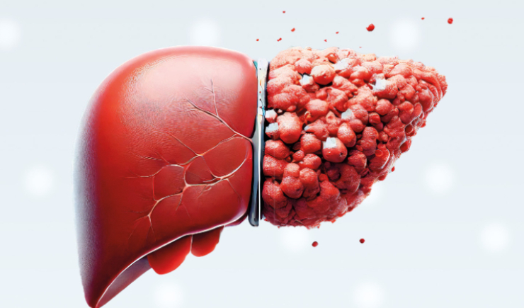 Farmacêuticos do SUS podem aumentar adesão ao tratamento de pessoas com hepatites virais