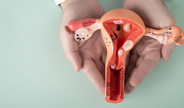 Comissão aprova atendimento prioritário para pacientes com endometriose no SUS
