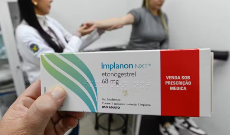 Contraceptivo de até R$ 4 mil passa a ser oferecido pelos planos de saúde