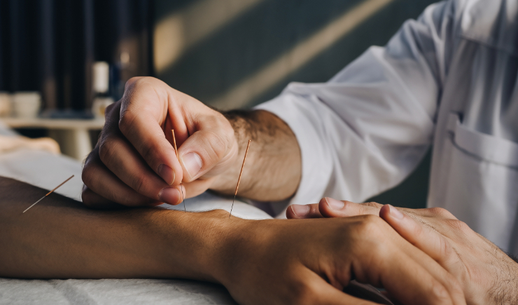Acupuntura é oficialmente regulamentada como profissão no Brasil