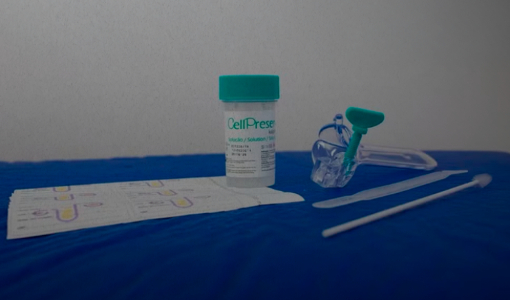 Novo exame gratuito do SUS detecta HPV com mais precisão