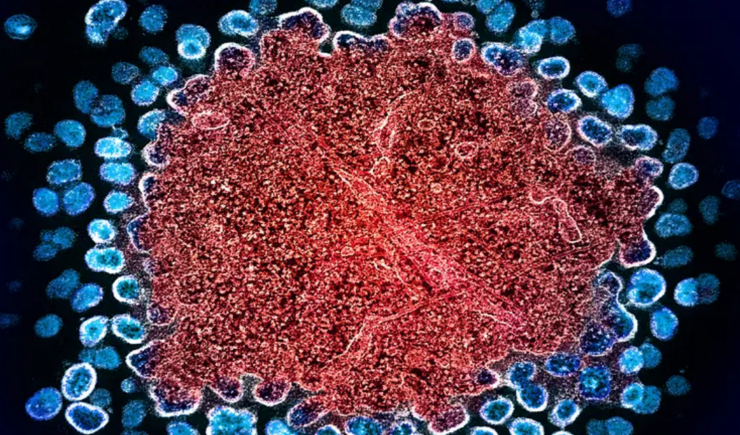 Dois novos casos de remissão do HIV são anunciados e renovam esperança na busca por uma cura