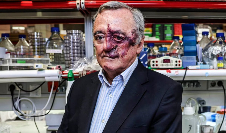 Bloqueio simultâneo de três alvos elimina tumores de pâncreas em modelos animais