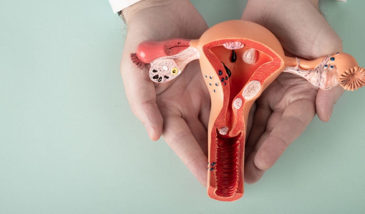 Comissão aprova atendimento prioritário para pacientes com endometriose no SUS