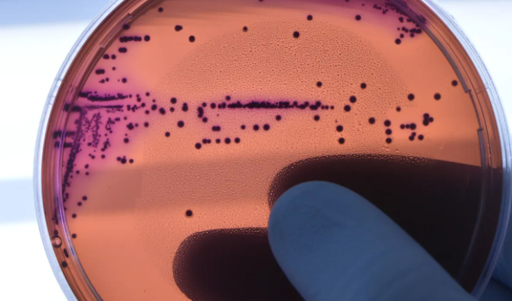 Estudo relacionou uso indiscriminado de antimicrobianos à resistência bacteriana na pandemia