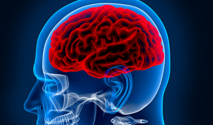 Casos e custos do AVC aumentam e desafiam o sistema de saúde no Brasil