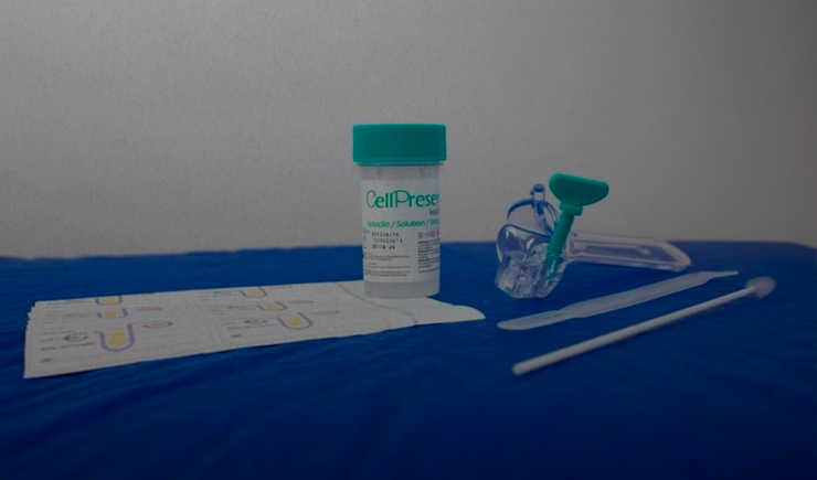 Novo exame gratuito do SUS detecta HPV com mais precisão