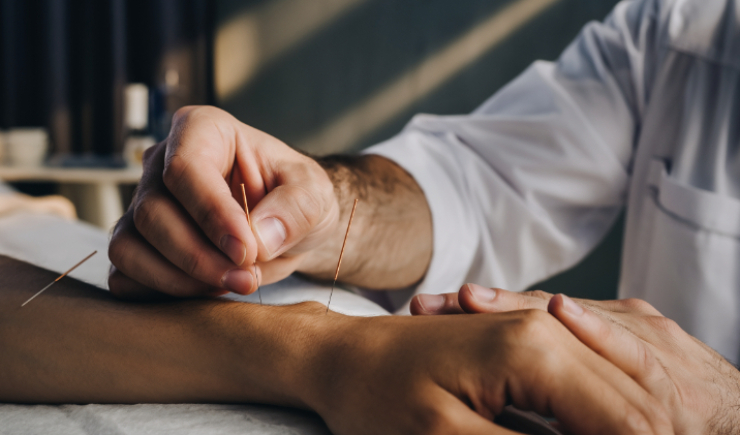 Acupuntura é oficialmente regulamentada como profissão no Brasil