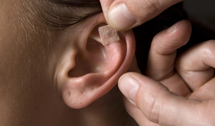 Ministério da Saúde abre inscrições para curso semipresencial de auriculoterapia