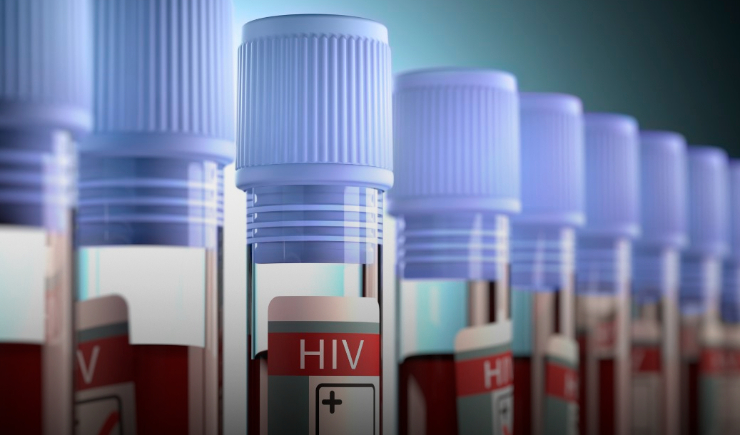 SUS vai incorporar medicamento para o cuidado de pessoas multiressistentes ao tratamento do HIV