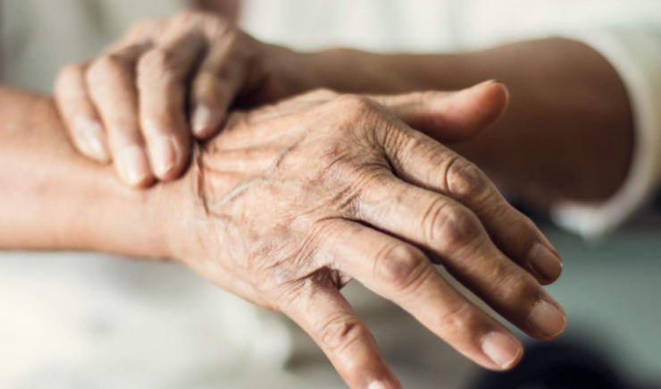Teste com sebo da pele pode diagnosticar Parkinson até sete anos antes dos sintomas