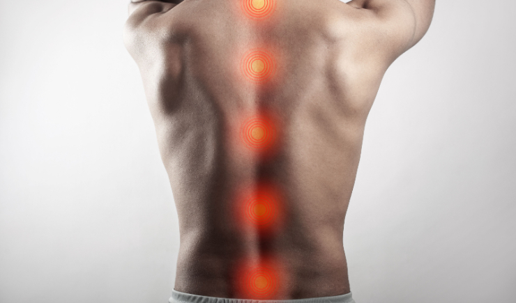 Polilaminina avança em testes clínicos e reacende expectativas no tratamento de lesões medulares