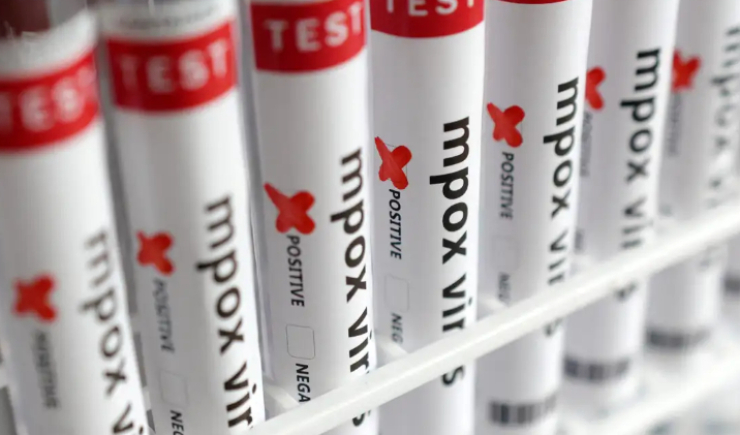 Brasil registra 55 casos de mpox em 2026 e mantém vigilância ativa